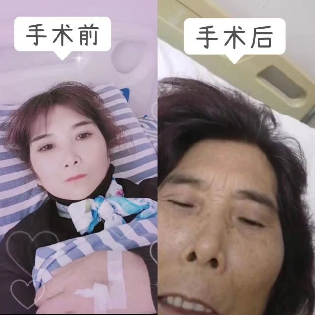 漯河一妇女在民营医院割痔疮感染命悬一线 源汇区卫健委应负监管责任